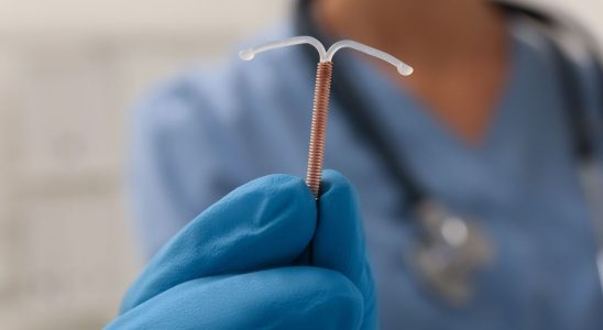 A woman becomes sterile after forgetting an IUD in her