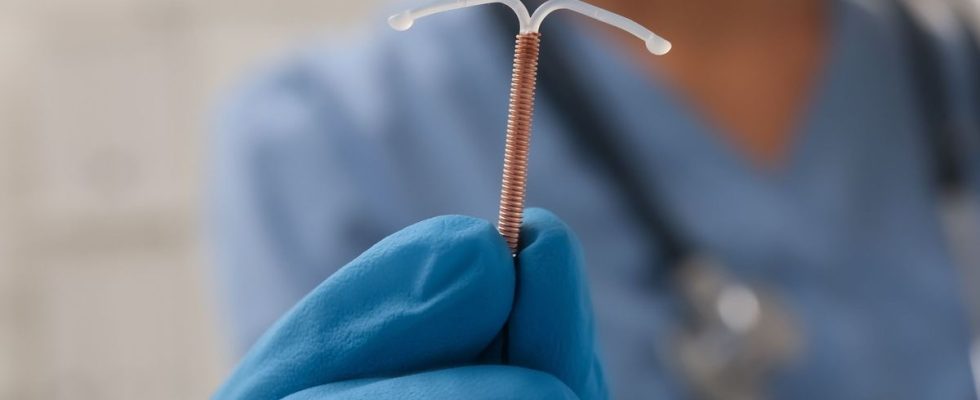 A woman becomes sterile after forgetting an IUD in her