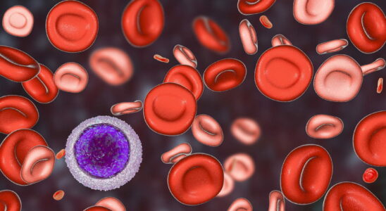 Anisocytosis is this blood abnormality serious