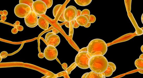 Candida auris this fungus that threatens the United States