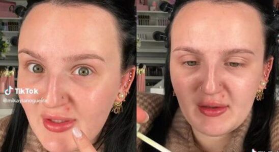 Discover the new TikTok trick to hide pimples and imperfections