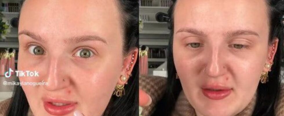 Discover the new TikTok trick to hide pimples and imperfections