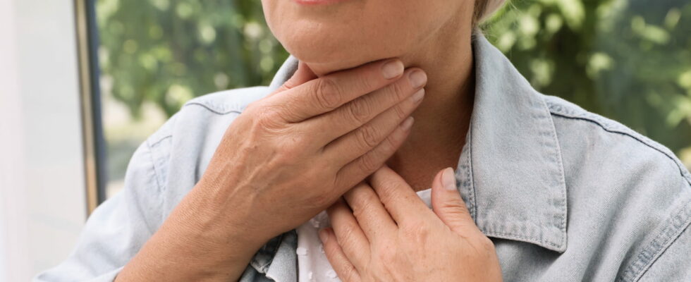 Goiter photo symptoms of an increased thyroid