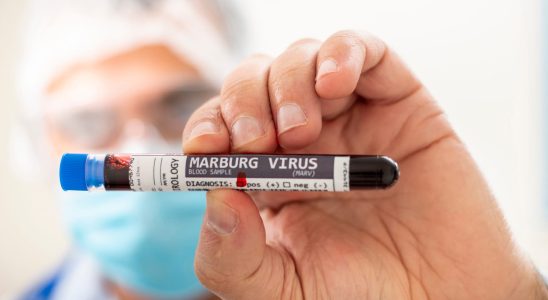 Marburg virus symptoms what are they in France