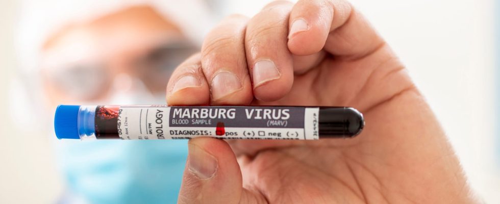 Marburg virus symptoms what are they in France