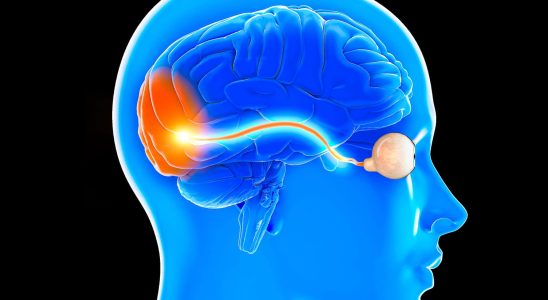 Optic neuritis symptoms causes what is this disease