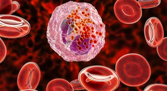 Polymorphonuclear eosinophils definition high low causes