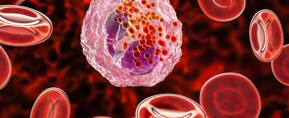 Polymorphonuclear eosinophils definition high low causes