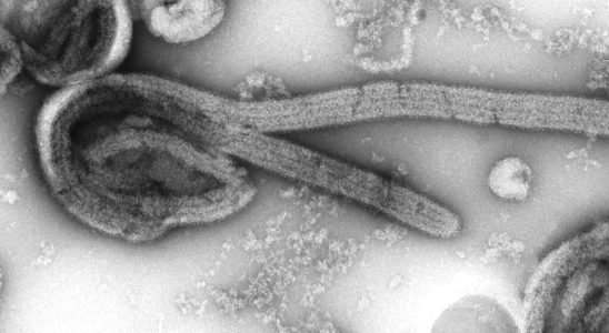 Tanzania confirms five Marburg virus deaths in the country