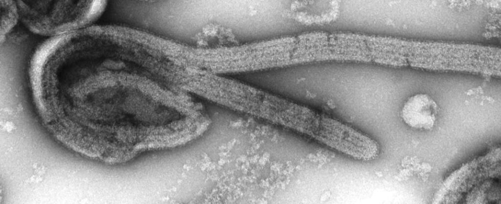 Tanzania confirms five Marburg virus deaths in the country