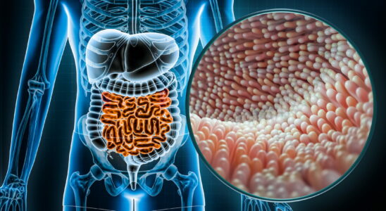 The 3 symptoms that can reveal colorectal cancer