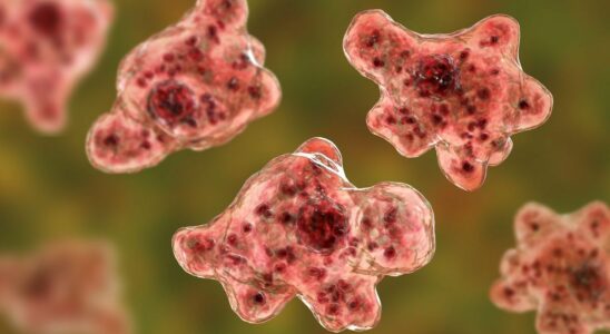 The brain eating amoeba attacks again in the United States