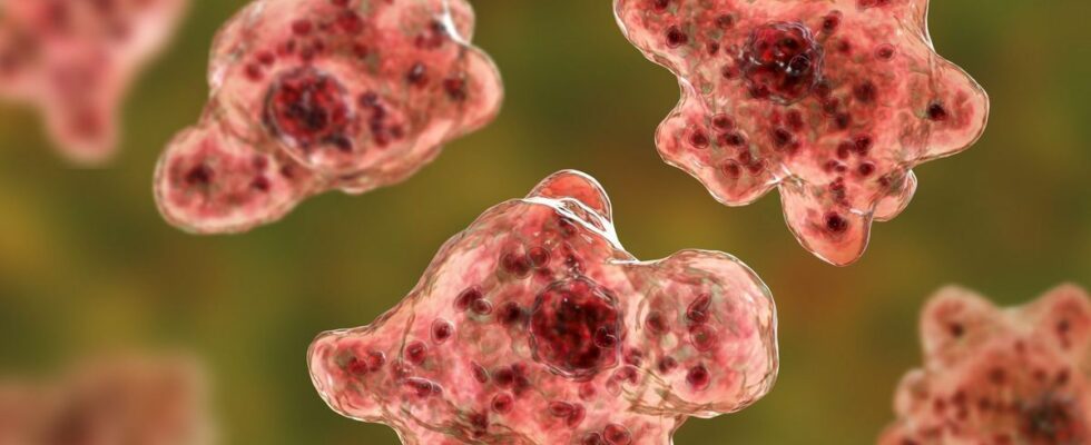 The brain eating amoeba attacks again in the United States