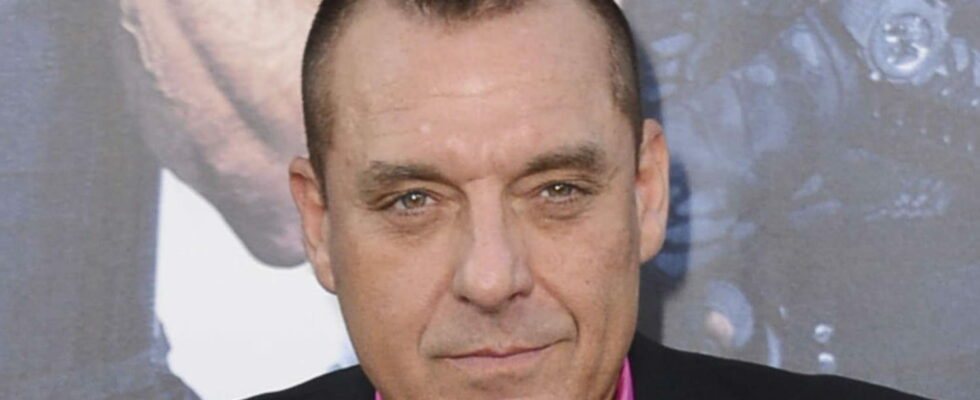 Tom Sizemore after his aneurysm rupture his family could end