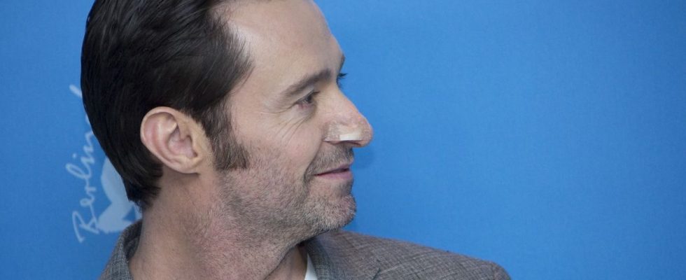 Skin cancer Hugh Jackman alert after undergoing two biopsies