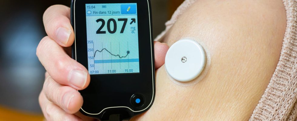 Type 1 diabetes symptoms age causes what is it