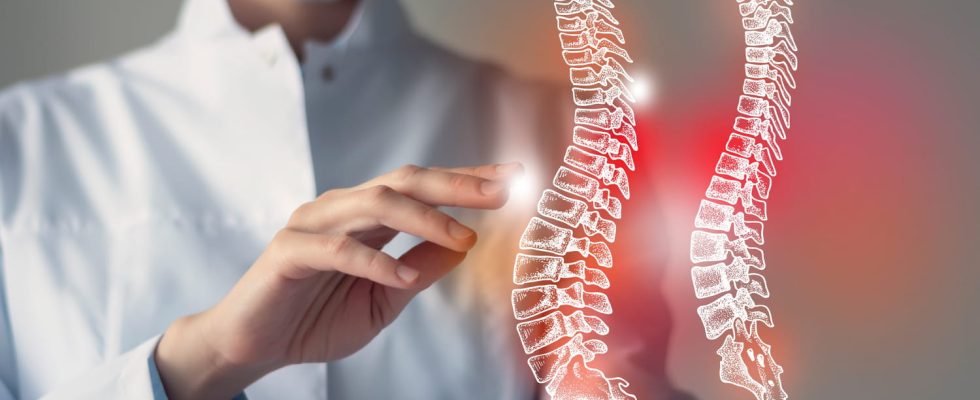 When to do a lumbar arthrodesis