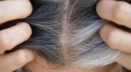 the key to avoiding gray hair could be at hand