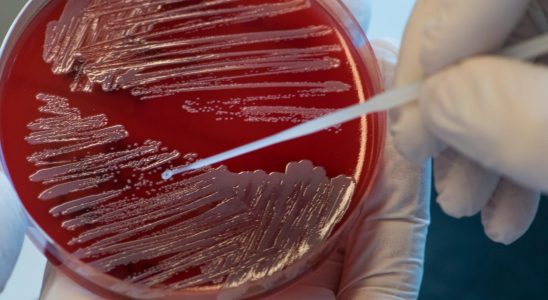 AI can find antibiotics against resistant bacteria