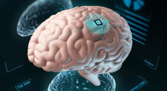 Another important step in the brain chip project The expected