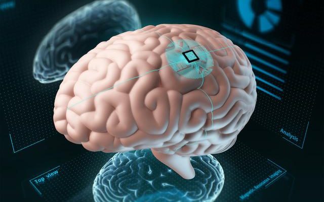 Another important step in the brain chip project The expected