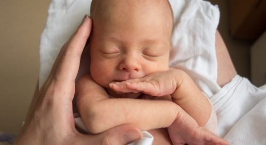 Baby has sticky eyes when to consult what to do