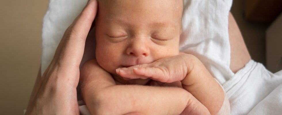 Baby has sticky eyes when to consult what to do