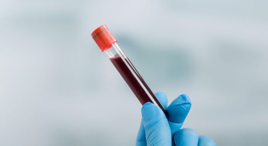 Biological blood test which examinations