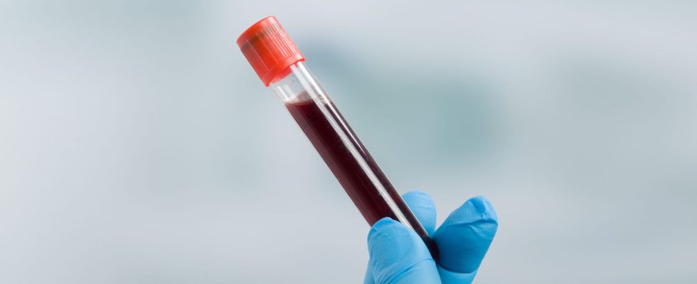 Biological blood test which examinations