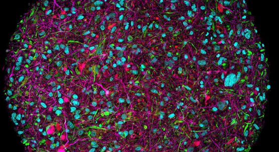 Boosting AI with Human Neurons The Fascinating Prospects of Organoid