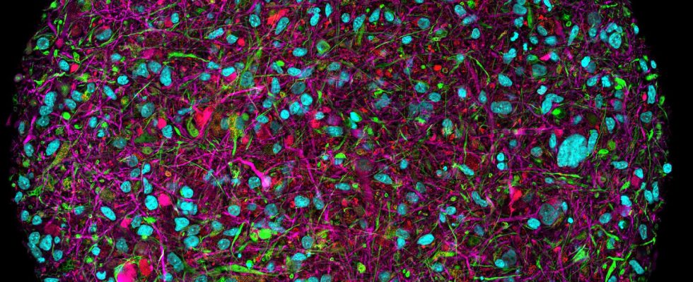 Boosting AI with Human Neurons The Fascinating Prospects of Organoid