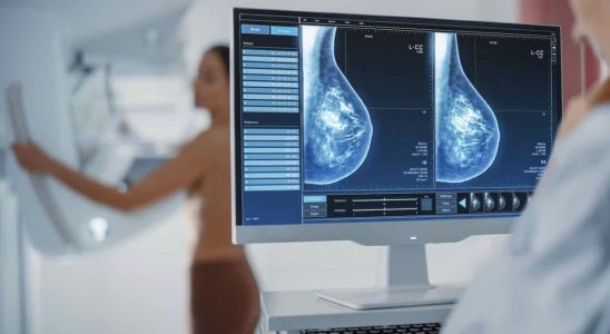 Breast cancer changes in breast density could be linked to