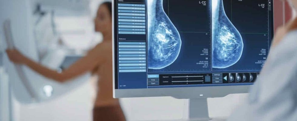 Breast cancer changes in breast density could be linked to