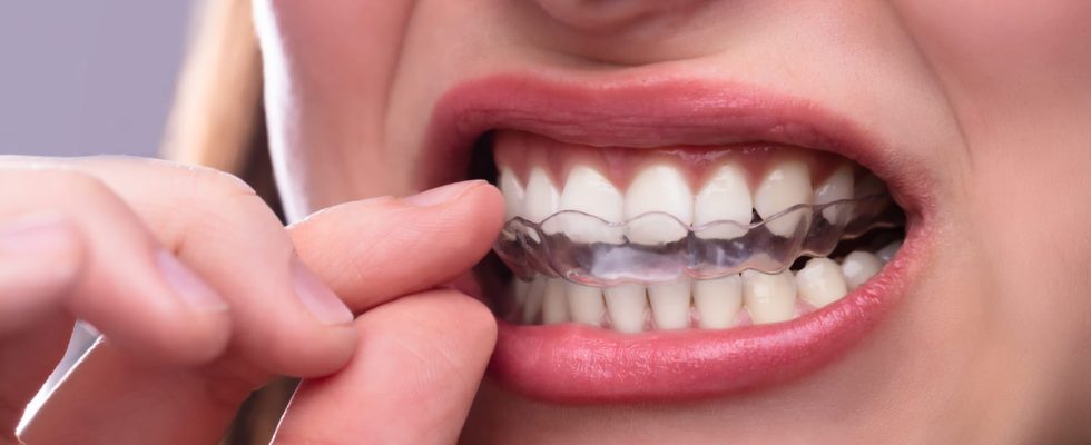 Bruxism symptoms gutters what miracle solution