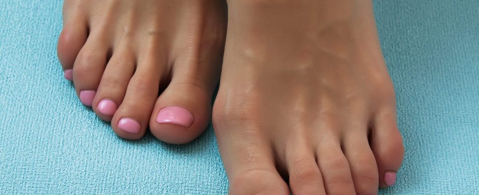 Dry feet what to do against corns and calluses