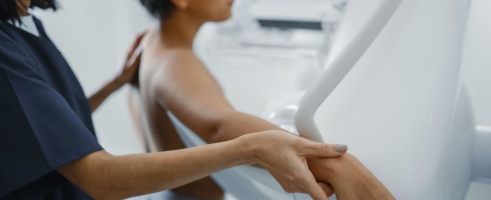 In the United States mammograms now recommended from the age