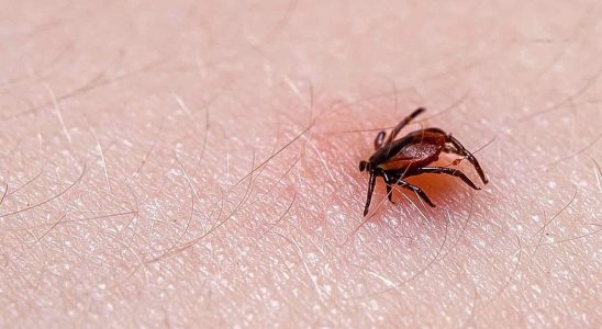 Lyme Disease Why Some Patients Have Persistent Symptoms