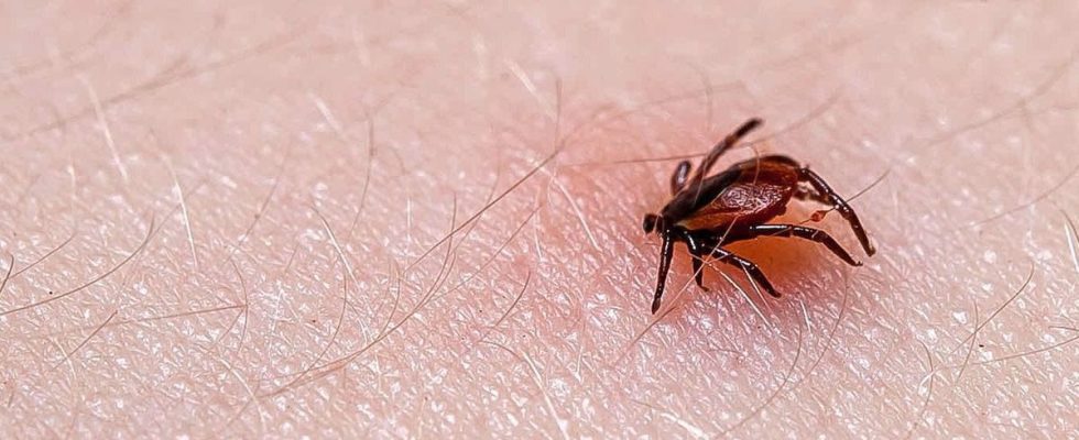 Lyme Disease Why Some Patients Have Persistent Symptoms