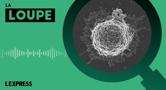 PODCAST Computers with human cells to boost AI