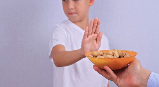 Peanut allergy a patch soon available for children