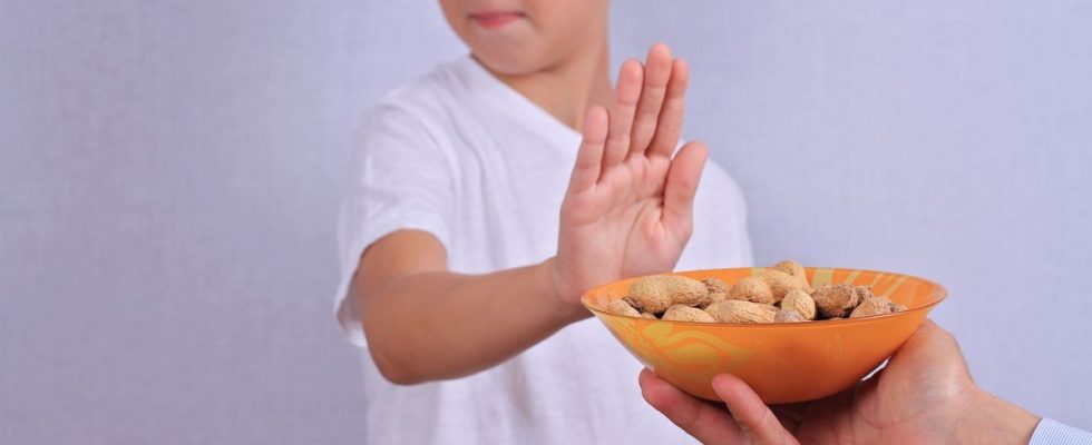 Peanut allergy a patch soon available for children