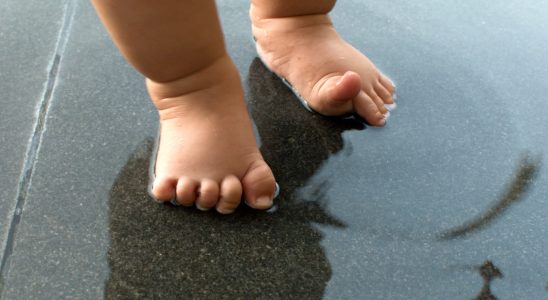 Plantar wart in children what to do