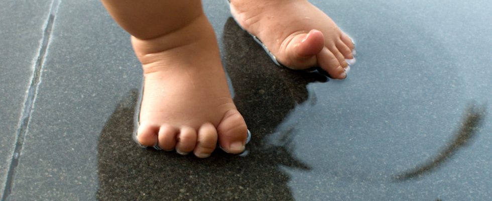 Plantar wart in children what to do