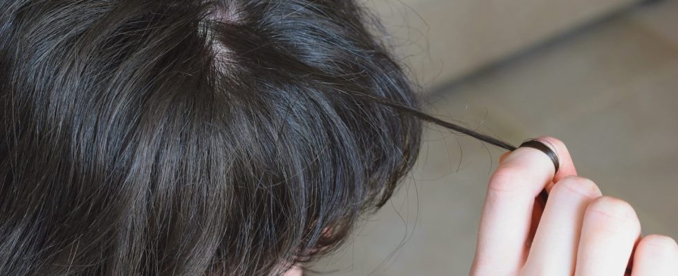 Trichotillomania hair eyelashes causes how to stop