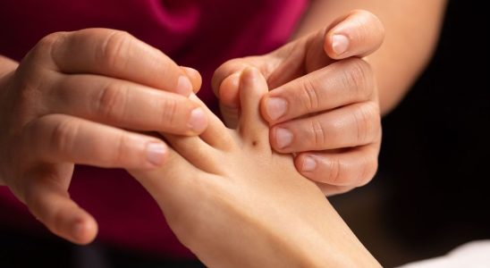 Woman Discovers Rare Tiny Cancer…Between Her Toes