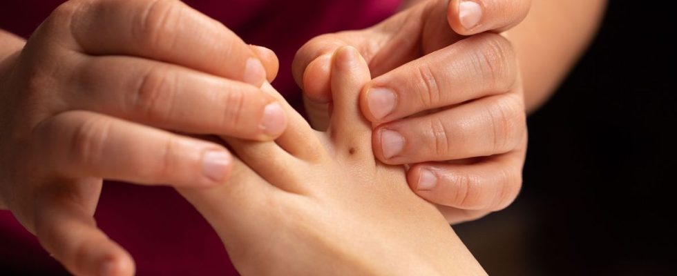 Woman Discovers Rare Tiny Cancer…Between Her Toes