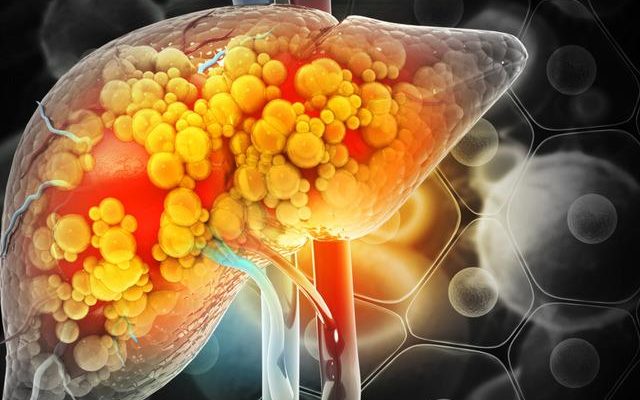 4 signs that your liver has a problem See a