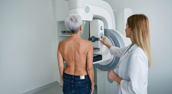 Breast cancer less than one in two women take part