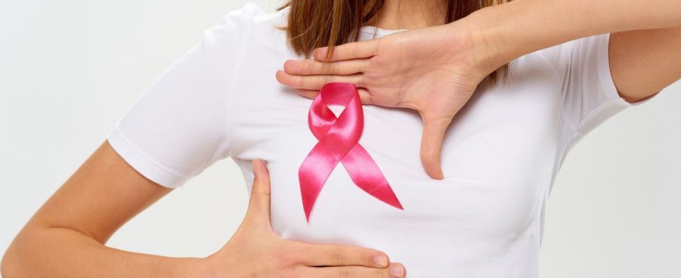 Early breast cancer the prognosis at 5 years has improved