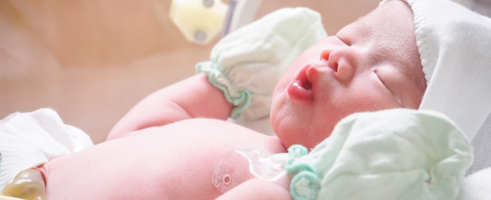 Esophageal atresia in the newborn complications